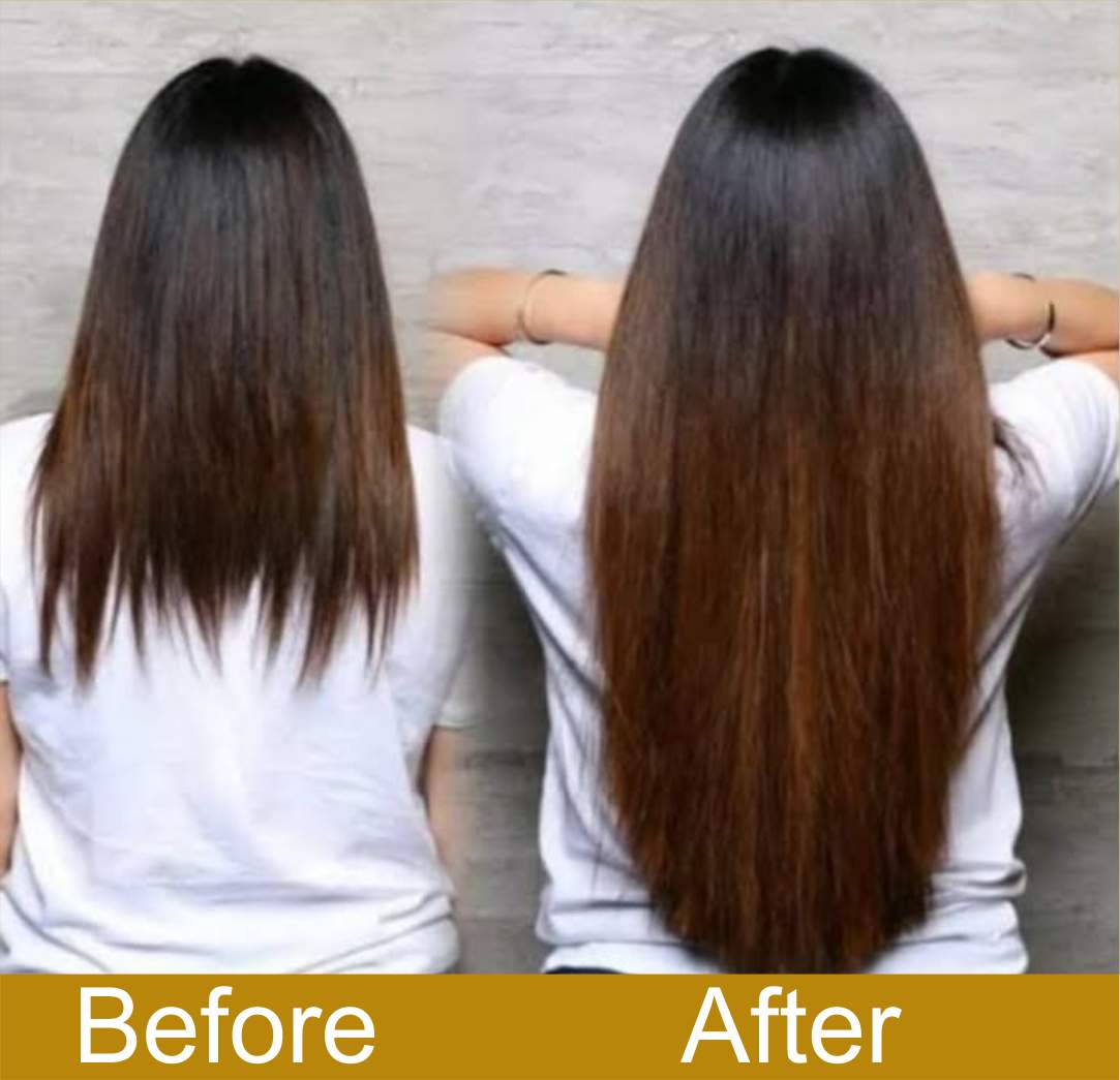Before & After Transformation 1
