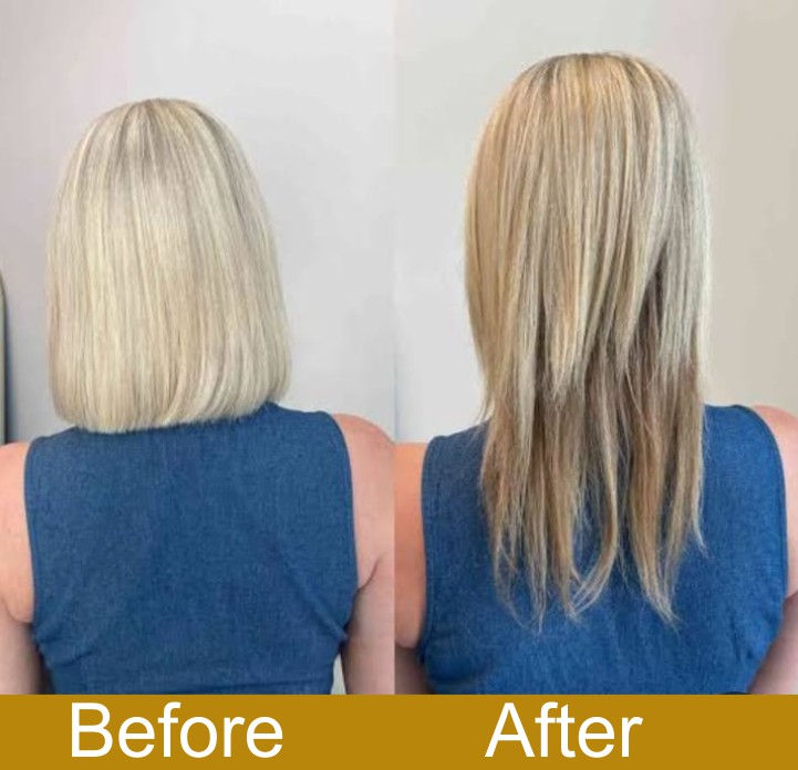 Before & After Transformation 4